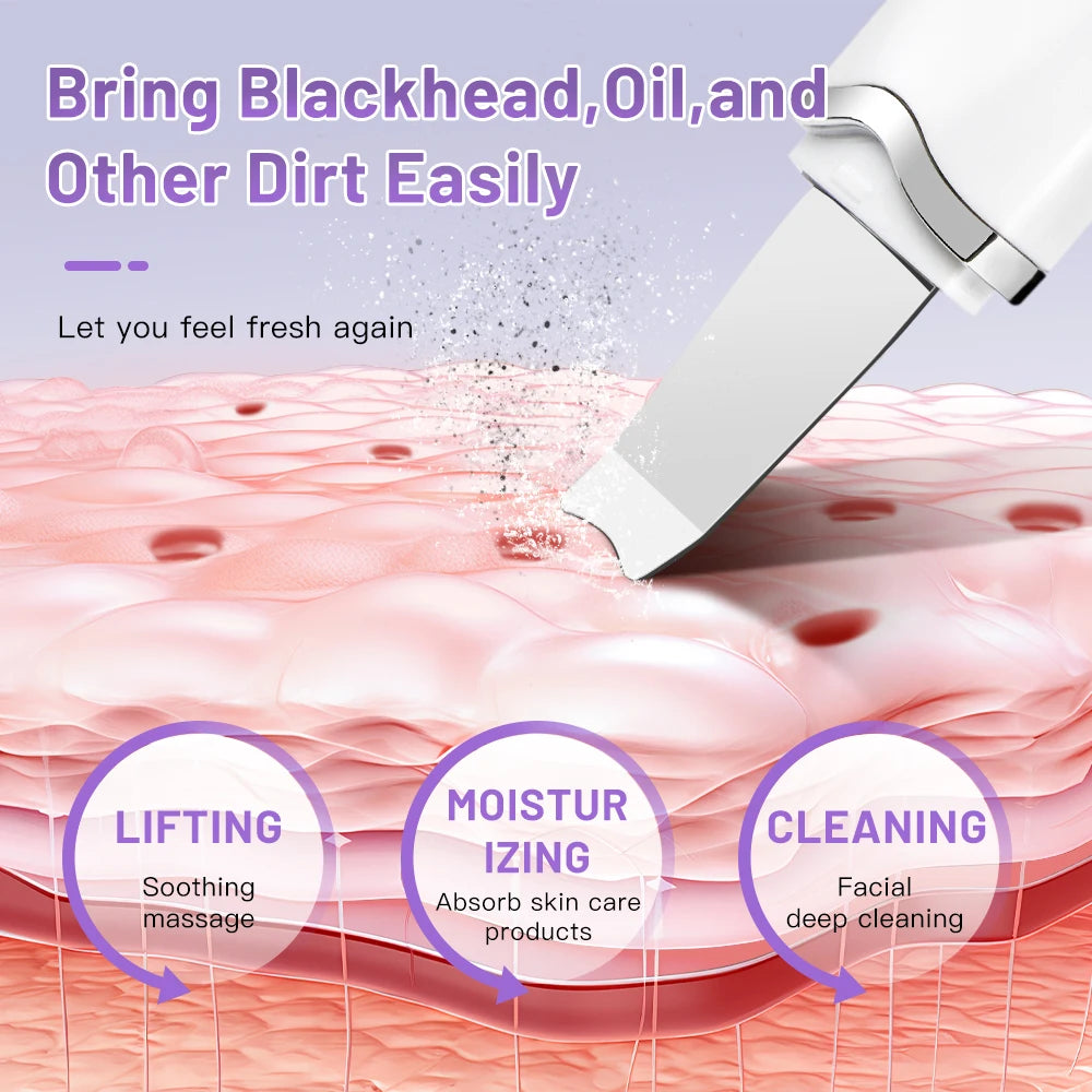 SOLVEA™ Ultrasonic Skin Scrubber