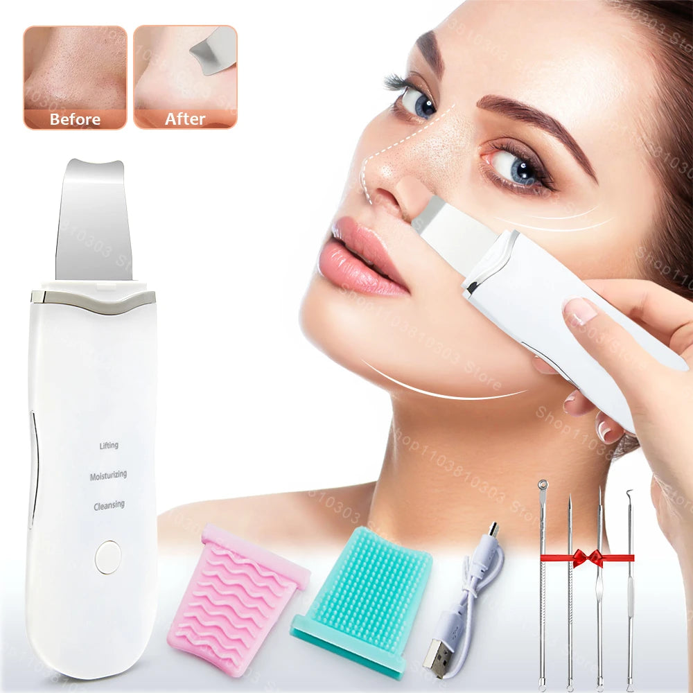 SOLVEA™ Ultrasonic Skin Scrubber