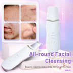 SOLVEA™ Ultrasonic Skin Scrubber